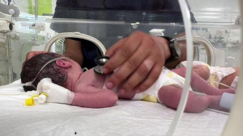 صابرين، الطفلة التي وُلِدَت من رحم أم قتلت خلال قصف إسرائيلي في رفح