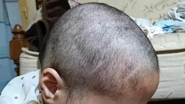 عذبوها وحلقوا شعرها.. واقعة عنف أسري بشعة تهز مصر والسبب "النقاب"