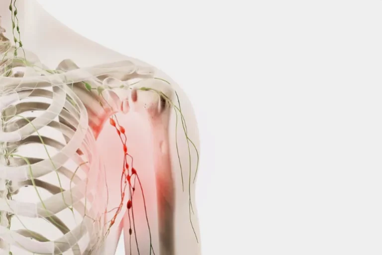 ‫ما أسباب تورم الغدد الليمفاوية تحت الإبط؟