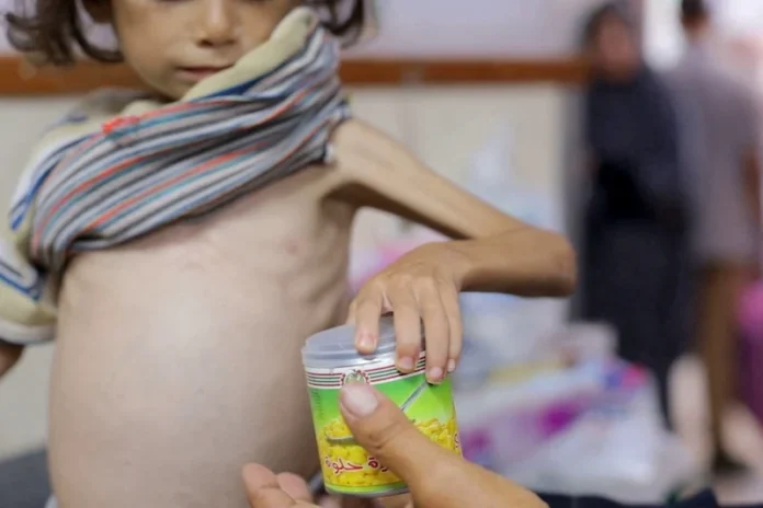 gaza-famine-enfant